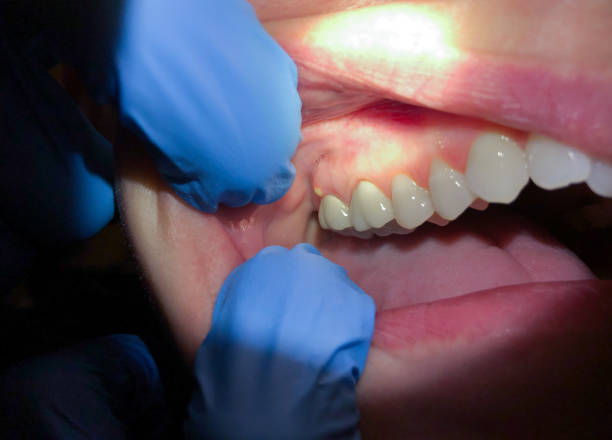 Best Emergency Orthodontic Repairs in Crossett, AR