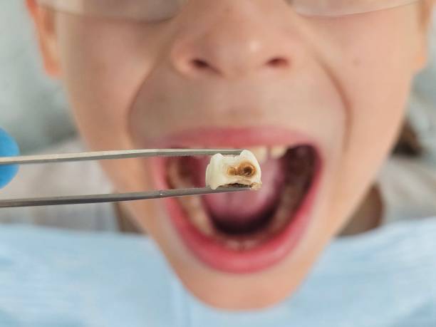 Best Emergency Root Canal Treatment in Crossett, AR